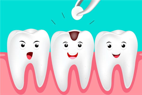 補(bǔ)牙多少錢(qián)一顆 補(bǔ)牙要注意什么