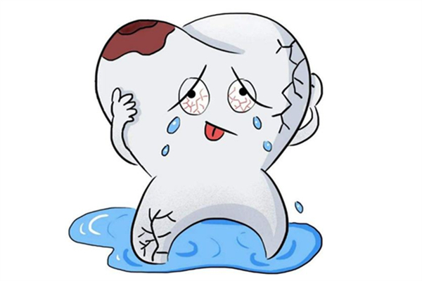 補(bǔ)牙是越貴越好嗎 補(bǔ)牙最好的方式 補(bǔ)牙是越貴越好嗎 補(bǔ)牙最好的方式