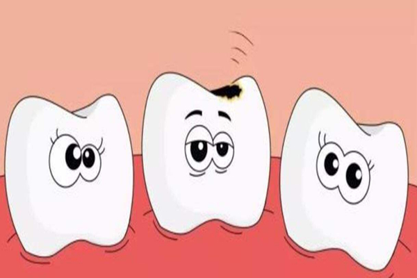 補(bǔ)牙是越貴越好嗎 補(bǔ)牙最好的方式 補(bǔ)牙是越貴越好嗎 補(bǔ)牙最好的方式