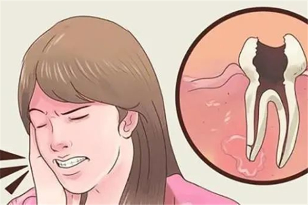 補(bǔ)牙會不會破壞里面的神經(jīng) 補(bǔ)牙對牙齒有傷害嗎