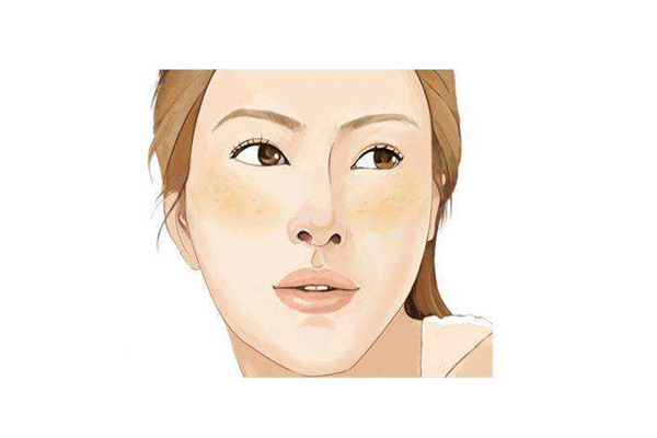 黃褐斑與抽煙有關系嗎 黃褐斑跟喝酒有沒有關系