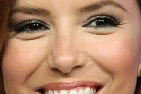 魚尾紋除皺針打一次能保持多久 魚尾紋除皺針有什么副作用 魚尾紋除皺針打一次能保持多久 魚尾紋除皺針有什么副作用