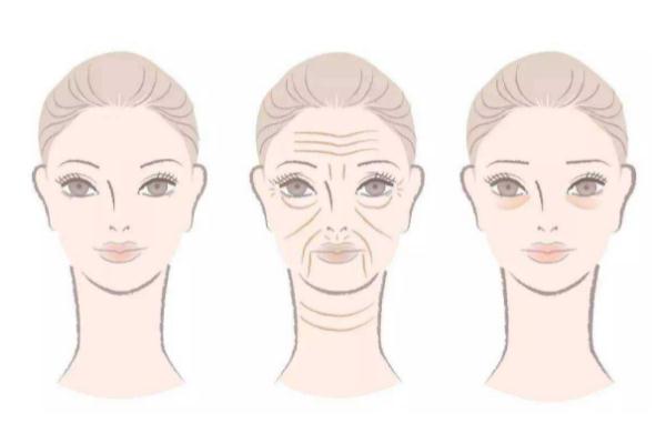 皺紋怎么樣才能去掉 皺紋是什么原因造成的 皺紋怎么樣才能去掉 皺紋是什么原因造成的