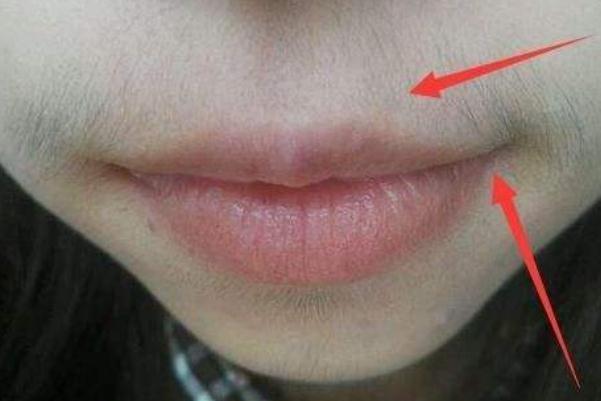 唇毛怎么去除永久 唇毛脫了會(huì)不會(huì)越長越多