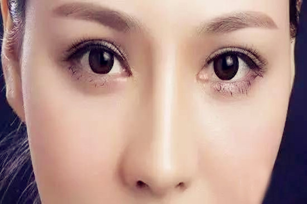 雙眼皮埋線是永久嗎 雙眼皮埋線是怎么弄的 雙眼皮埋線是永久嗎 雙眼皮埋線是怎么弄的