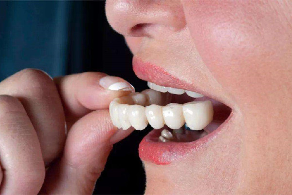 烤瓷牙和全瓷牙哪種好 烤瓷牙和全瓷牙價(jià)格 烤瓷牙和全瓷牙哪種好 烤瓷牙和全瓷牙價(jià)格