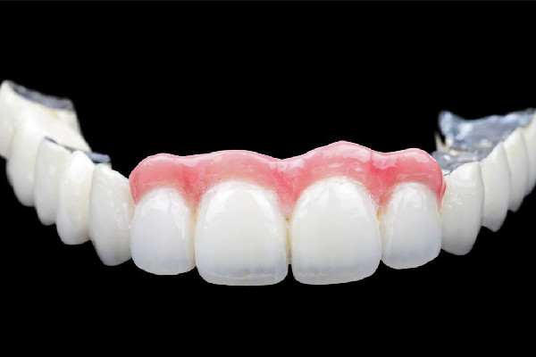 烤瓷牙的材料有幾種 烤瓷牙用什么膠粘最好 烤瓷牙的材料有幾種 烤瓷牙用什么膠粘最好