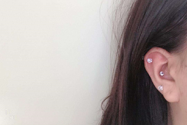 打耳骨怎么預(yù)防增生 打耳骨增生了怎么辦 打耳骨怎么預(yù)防增生 打耳骨增生了怎么辦