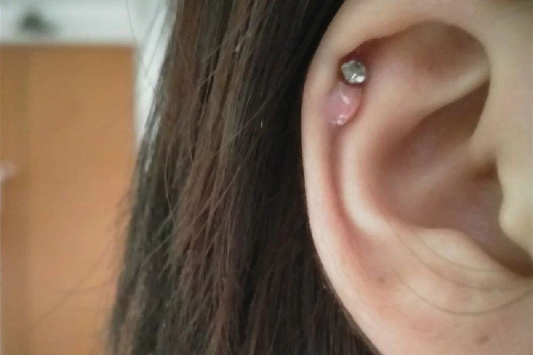 打耳骨疼嗎 打耳骨有什么危害 打耳骨疼嗎 打耳骨有什么危害