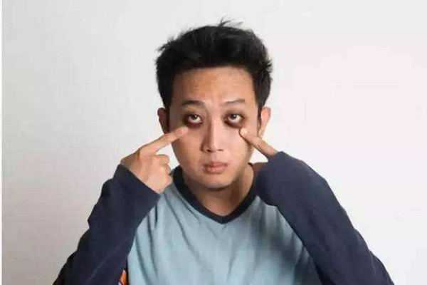 黑眼圈很嚴(yán)重怎么回事 黑眼圈很嚴(yán)重是得病了嗎 黑眼圈很嚴(yán)重怎么回事 黑眼圈很嚴(yán)重是得病了嗎