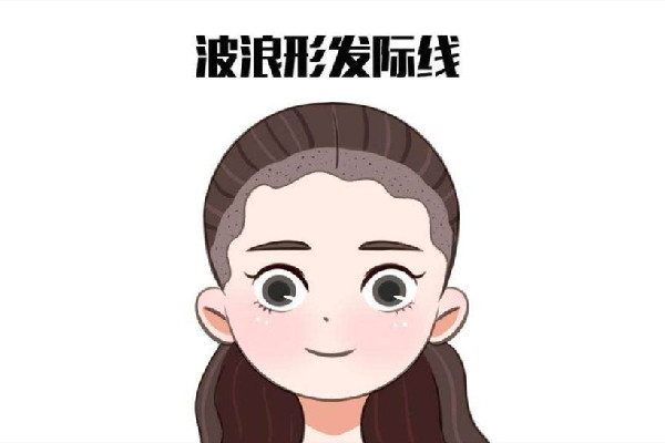 發(fā)際線后移怎么恢復(fù) 發(fā)際線后移是什么原因引起的