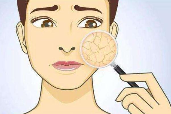 皮膚干燥脫皮嚴(yán)重像魚(yú)鱗怎么辦 皮膚干燥起皮像魚(yú)鱗是怎么回事 皮膚干燥脫皮嚴(yán)重像魚(yú)鱗怎么辦 皮膚干燥起皮像魚(yú)鱗是怎么回事