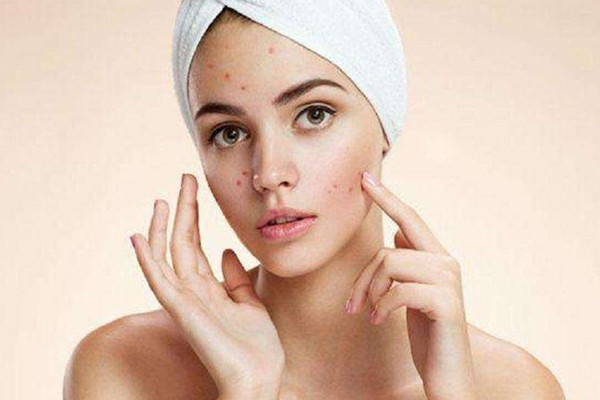 痘痘擠了之后能用酒精消毒嗎 痘痘擠了之后能用蘆薈膠嗎