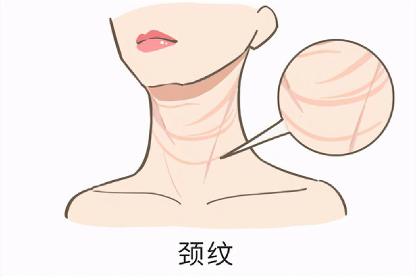 頸紋用開(kāi)塞露有用嗎 頸紋用什么護(hù)膚品好