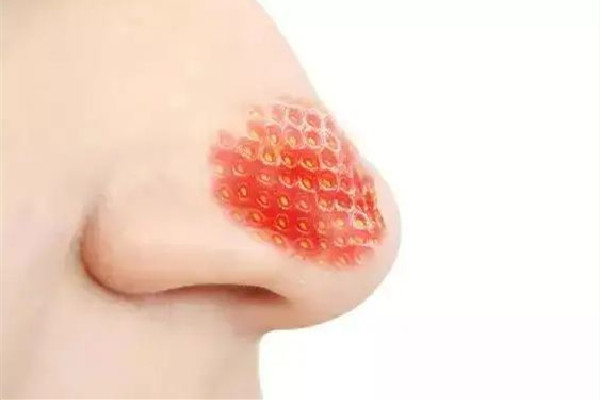 去黑頭洗面奶排行榜前十名 去黑頭洗面奶什么牌子好 去黑頭洗面奶排行榜前十名 去黑頭洗面奶什么牌子好