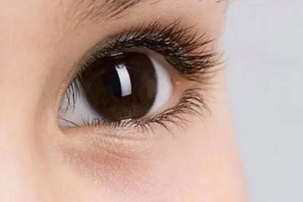 開眼角的副作用 開眼角的線沒(méi)拆干凈有影響嗎