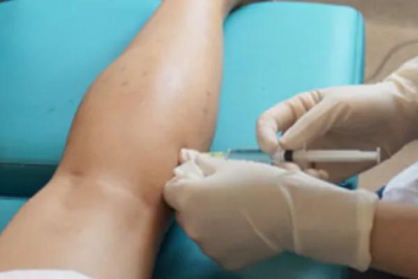 瘦腿針的原理 瘦腿針的危害有什么副作用 瘦腿針的原理 瘦腿針的危害有什么副作用