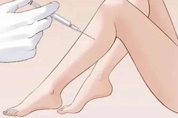 瘦腿針是瘦小腿還是大腿 瘦腿針打了能瘦大腿嗎 瘦腿針是瘦小腿還是大腿 瘦腿針打了能瘦大腿嗎