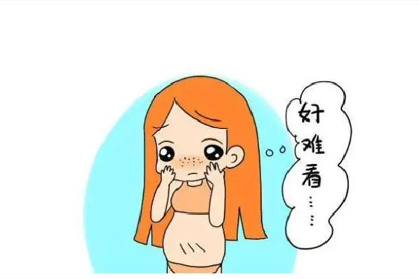 妊娠紋初期可以消掉嗎 妊娠紋初期怎么控制繼續(xù)擴(kuò)張 妊娠紋初期可以消掉嗎 妊娠紋初期怎么控制繼續(xù)擴(kuò)張