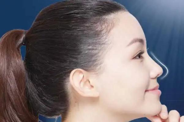 膨體隆鼻要忌口多長時(shí)間 膨體隆鼻有什么危害