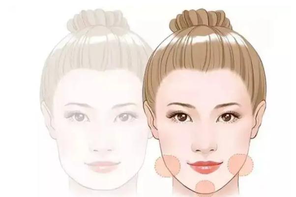 豐下巴是永久的嗎 豐下巴是從正面還是側(cè)面 豐下巴是永久的嗎 豐下巴是從正面還是側(cè)面