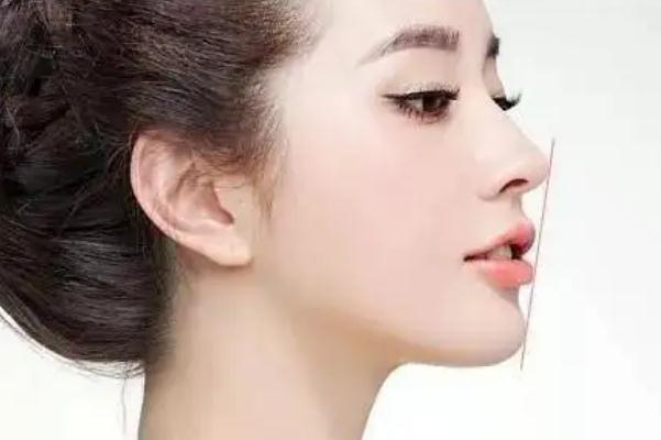 豐下巴哪種方法最好 豐下巴需要多少錢(qián)