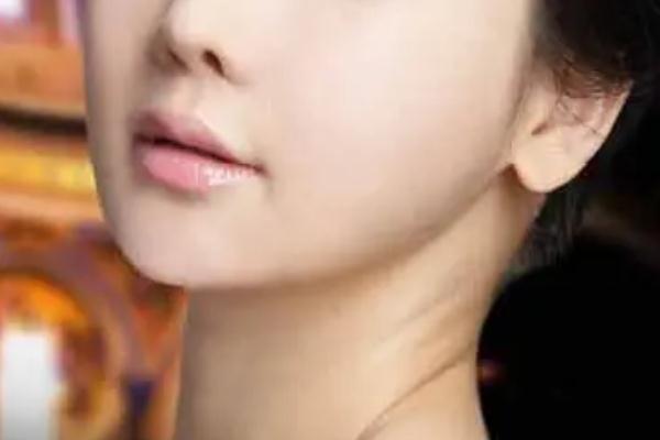 豐下巴會不會產生木偶紋 豐下巴會不會臉部下垂 豐下巴會不會產生木偶紋 豐下巴會不會臉部下垂