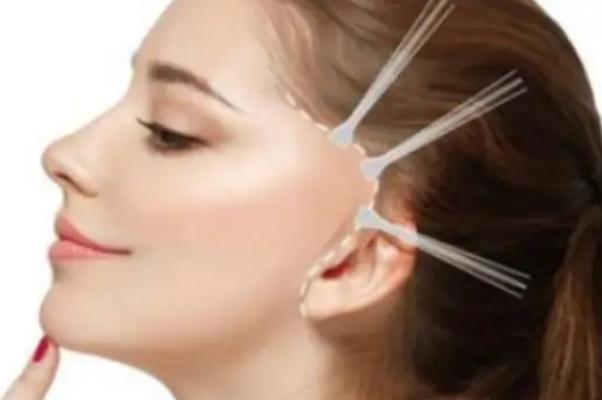 拉皮手術(shù)會把鼻子拉寬嗎 拉皮手術(shù)會腫幾天 拉皮手術(shù)會把鼻子拉寬嗎 拉皮手術(shù)會腫幾天