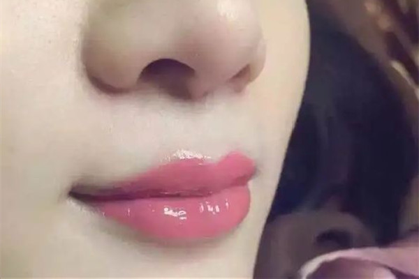 漂唇一般幾天可以恢復(fù) 漂唇后的注意事項(xiàng) 漂唇一般幾天可以恢復(fù) 漂唇后的注意事項(xiàng)