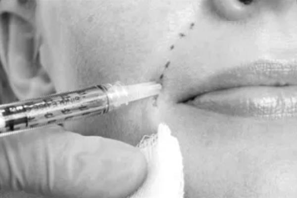 童顏針會(huì)凹凸不平嗎 童顏針對(duì)身體有害嗎 童顏針會(huì)凹凸不平嗎 童顏針對(duì)身體有害嗎