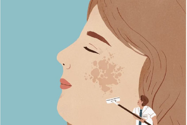 刷酸的時候臉上火辣辣的正常嗎 刷酸后臉部發(fā)紅怎么辦 刷酸的時候臉上火辣辣的正常嗎 刷酸后臉部發(fā)紅怎么辦