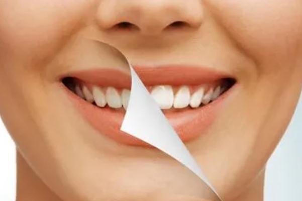 冷光美白牙齒要做幾次 牙齒冷光美白的機(jī)理 冷光美白牙齒要做幾次 牙齒冷光美白的機(jī)理