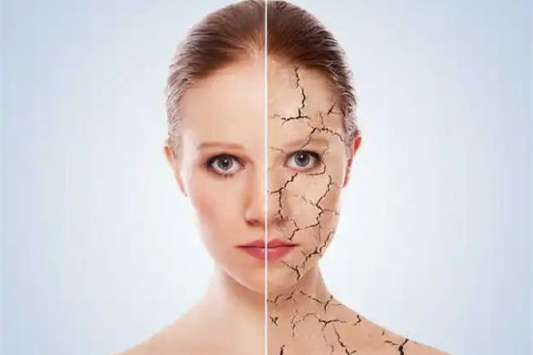 膠原蛋白填充后為什么越來越腫 膠原蛋白填充多久恢復自然