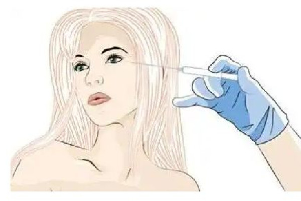 膠原蛋白填充眼窩凹陷保持多久 膠原蛋白填充臉部安全嗎 膠原蛋白填充眼窩凹陷保持多久 膠原蛋白填充臉部安全嗎