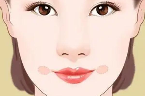 人造酒窩能保持多久 人造酒窩不笑會(huì)有窩嗎 人造酒窩能保持多久 人造酒窩不笑會(huì)有窩嗎