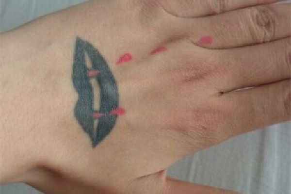 洗紋身會有增生疤痕嗎 洗紋身有點凸起來正常嗎