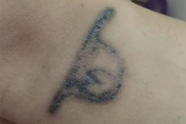 洗紋身敷麻藥嗎 洗紋身敷麻藥對(duì)人體有沒(méi)有傷害 洗紋身敷麻藥嗎 洗紋身敷麻藥對(duì)人體有沒(méi)有傷害