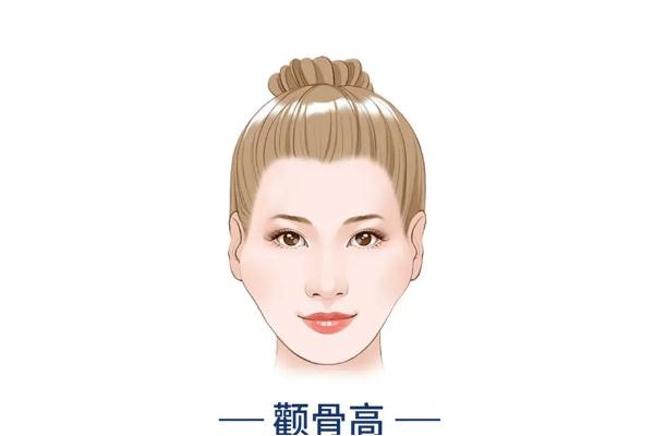 顴骨內(nèi)推要開刀嗎 顴骨內(nèi)推有生命危險(xiǎn)嗎