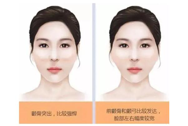 顴骨內推手術多少錢啊 顴骨內推后遺癥