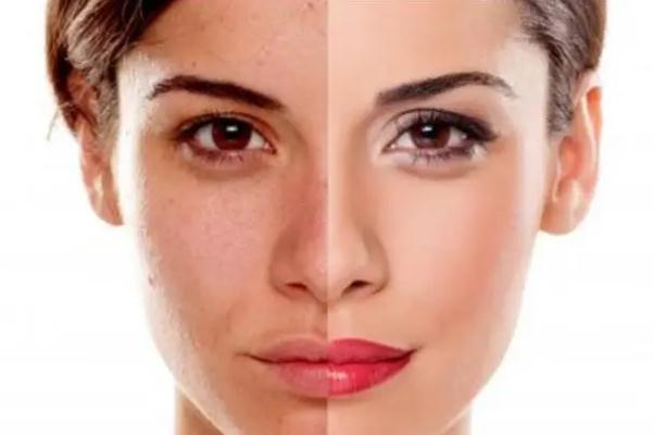 皮膚暗黃會(huì)造成什么影響 皮膚暗黃會(huì)自然恢復(fù)嗎 皮膚暗黃會(huì)造成什么影響 皮膚暗黃會(huì)自然恢復(fù)嗎