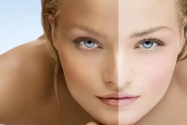 皮膚暗黃會(huì)造成什么影響 皮膚暗黃會(huì)自然恢復(fù)嗎 皮膚暗黃會(huì)造成什么影響 皮膚暗黃會(huì)自然恢復(fù)嗎