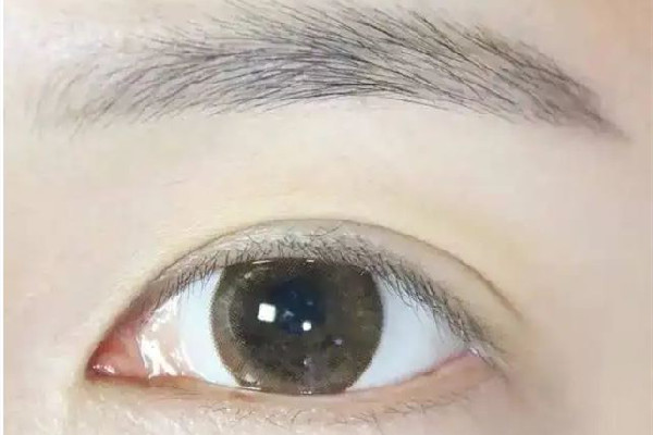 刮眉毛后有點痛怎么辦 刮眉毛后怎么護(hù)理 刮眉毛后有點痛怎么辦 刮眉毛后怎么護(hù)理