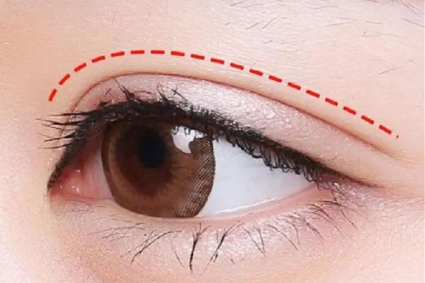 武漢雙眼皮埋線哪家醫(yī)院最好 武漢雙眼皮埋線價(jià)格 武漢雙眼皮埋線哪家醫(yī)院最好 武漢雙眼皮埋線價(jià)格