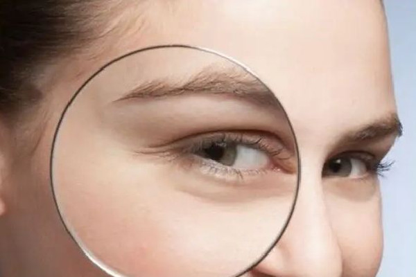 武漢眼角除皺針多少錢一針 武漢打眼角除皺針去哪里打 武漢眼角除皺針多少錢一針 武漢打眼角除皺針去哪里打