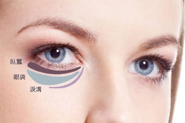 武漢下眼袋摘除手術多少錢 武漢下眼袋摘除手術醫(yī)院