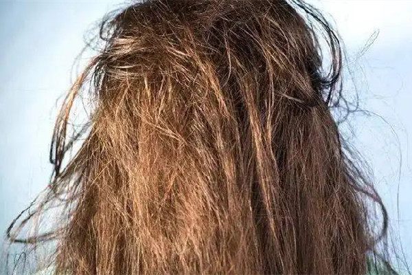 干性頭發(fā)要天天洗頭嗎 干性頭發(fā)要用護發(fā)素嗎