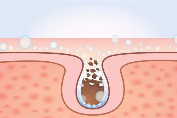 江漢路店一格皮膚美容管理中心皮膚檢測做的怎么樣 江漢路店一格