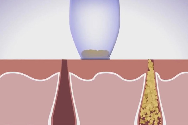 江漢路店一格皮膚美容管理中心皮膚檢測做的怎么樣 江漢路店一格皮膚美容管理中心毛孔清潔做的好嗎 江漢路店一格皮膚美容管理中心皮膚檢測做的怎么樣 江漢路店一格皮膚美容管理中心毛孔清潔做的好嗎