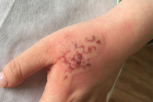 江漢路步行街眾刺紋畫·穿刺·洗紋身·遮蓋店洗紋身會(huì)疼嗎 洗紋身的方法有幾種