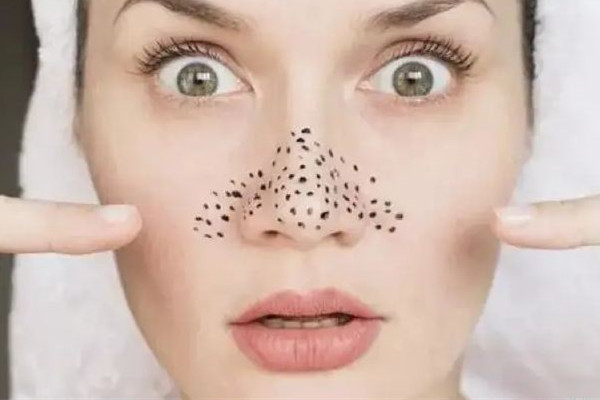 光谷天地傾顏皮膚管理中心去黑頭專業(yè)嗎 去黑頭會不會越來越嚴(yán)重